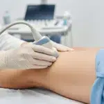 Vascular Ultrasound Testing Close-up of a doctor using an ultrasound probe on a patient's leg to assess blood flow and check for vein issues (vascular ultrasound).
