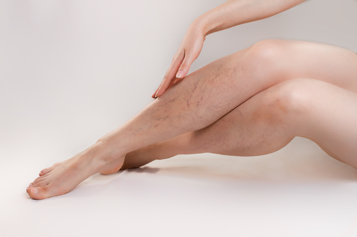 what-to-expect-during-a-vascular-ultrasound What to Expect During a Vascular Ultrasound